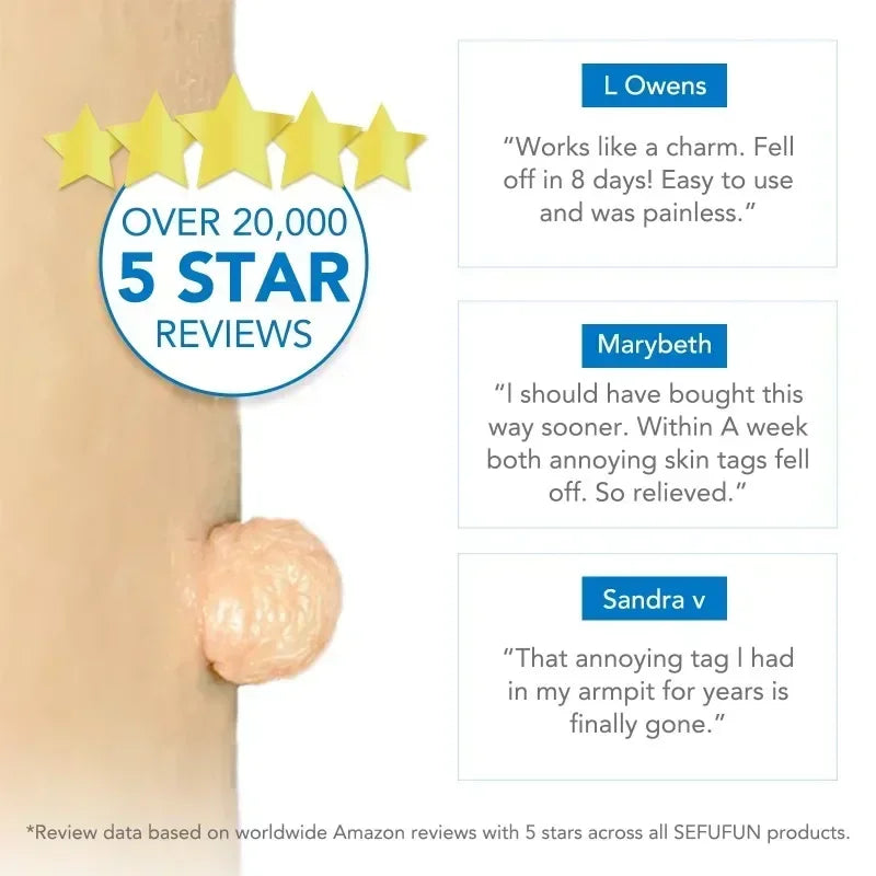 Simple Skin Tag Removal Tool