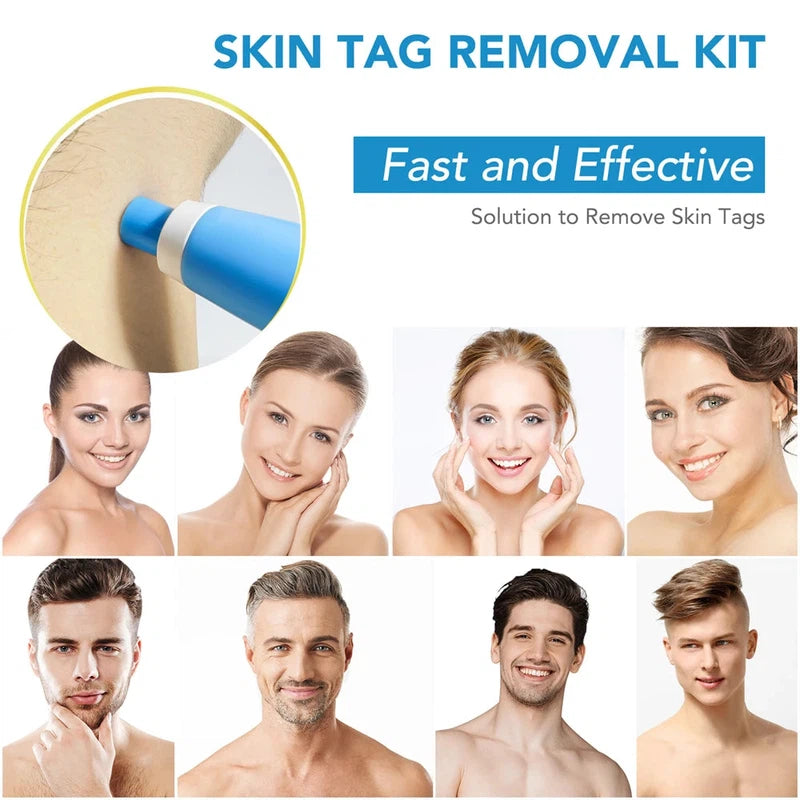 Double Headed Pen Set Auto Skin Tag Remover Kit