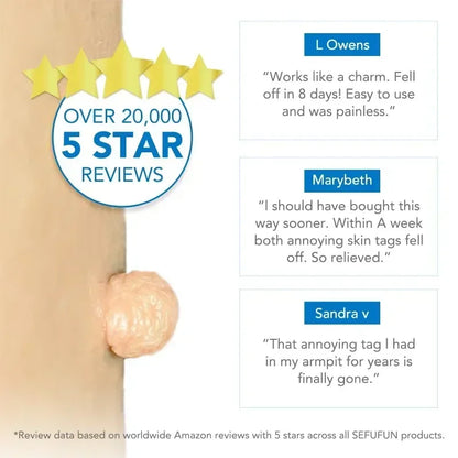 Simple Skin Tag Removal Tool
