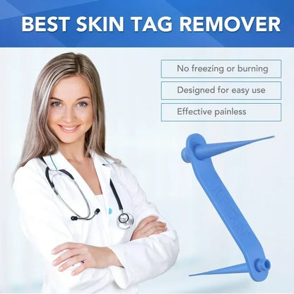 Simple Skin Tag Removal Tool